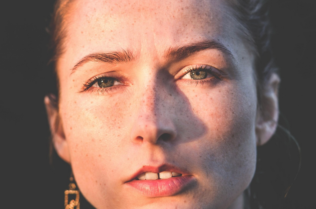 Smoking and Accelerated Skin Aging: Links to Psoriasis and Skin Health Risks - Quitine