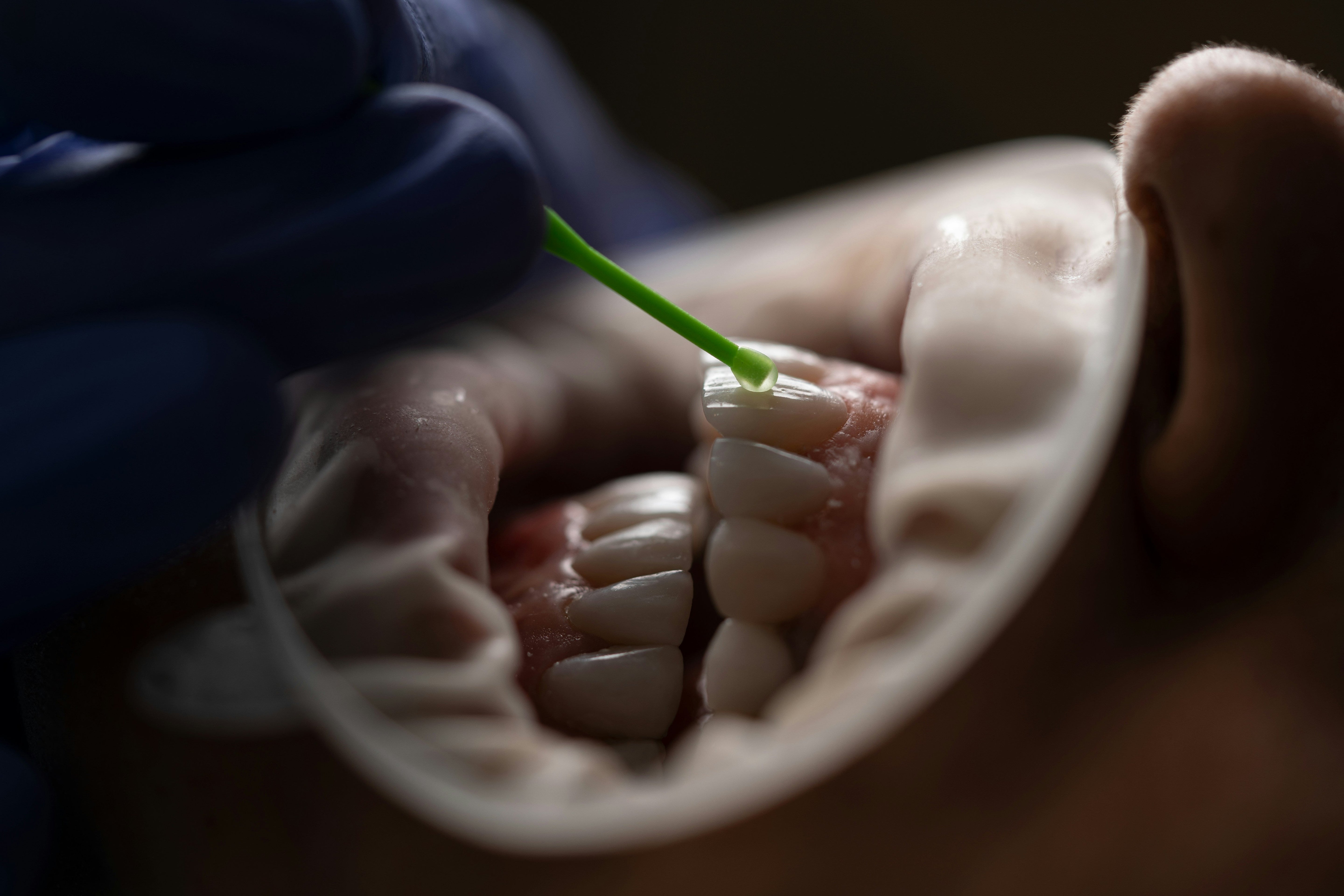 Using Nicotine Gum with Dentures or Braces: Tips for Quitting Smoking with Dental Work - Quitine